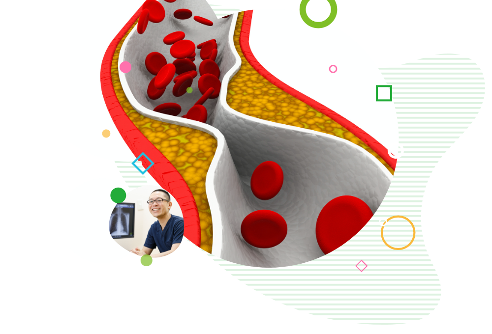 高コレステロール血症とは何ですか?