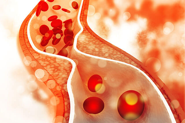 diabetes-19